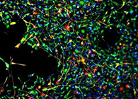 天下首创：药物将干细胞指导至受损部位，，，，提高其愈合能力！