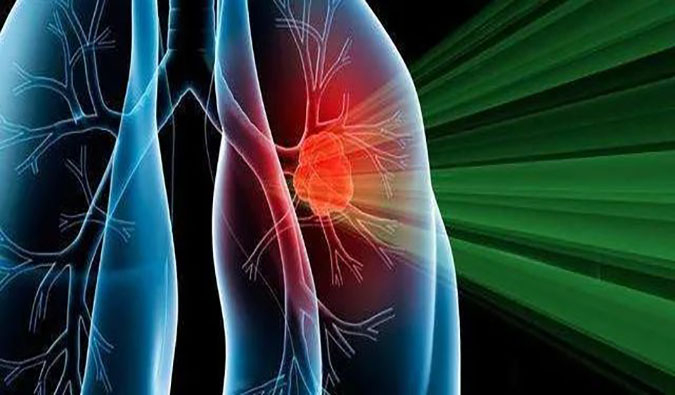 盛世泰科1类立异药物CGT-9475实现中美双报双批 | 玩彩网一站式临床宿世物医药研发服务平台助力