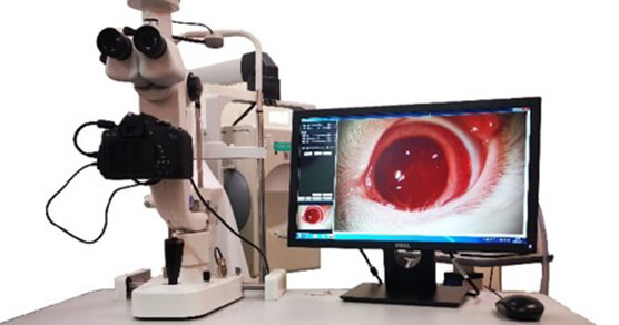 数码裂隙灯（YZ5T裂隙灯显微镜）