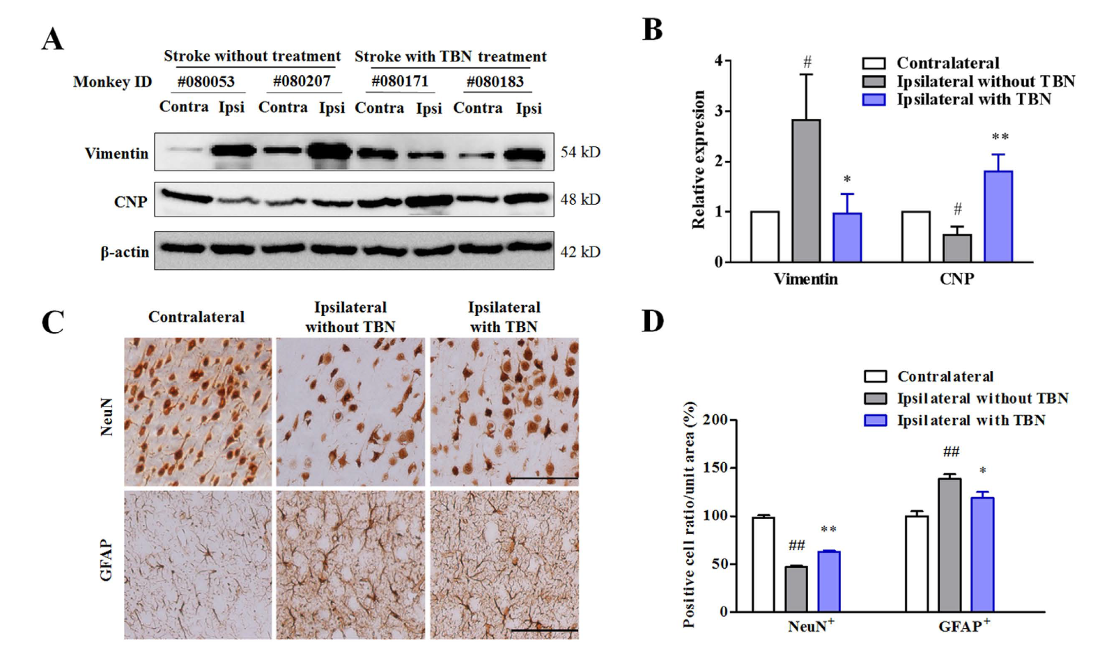 TBN是一种治疗缺血性卒中的新型临床候选药物，，，，，本研究中TBN通过玩彩网合成